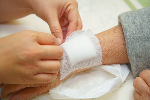 Wound Healing