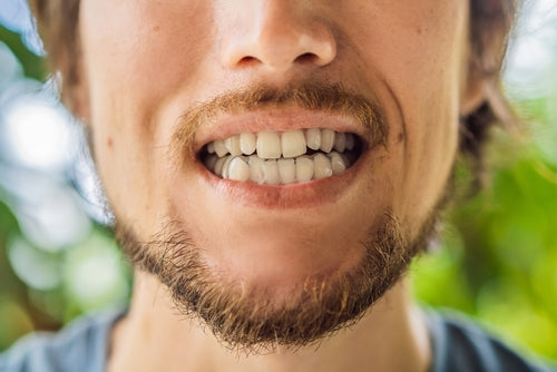 Bruxism (Teeth Grinding)