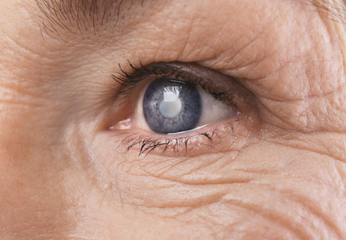 Glaucoma Relief